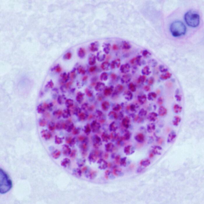 The Little-Known Parasite That Infects Millions of Americans Every Year