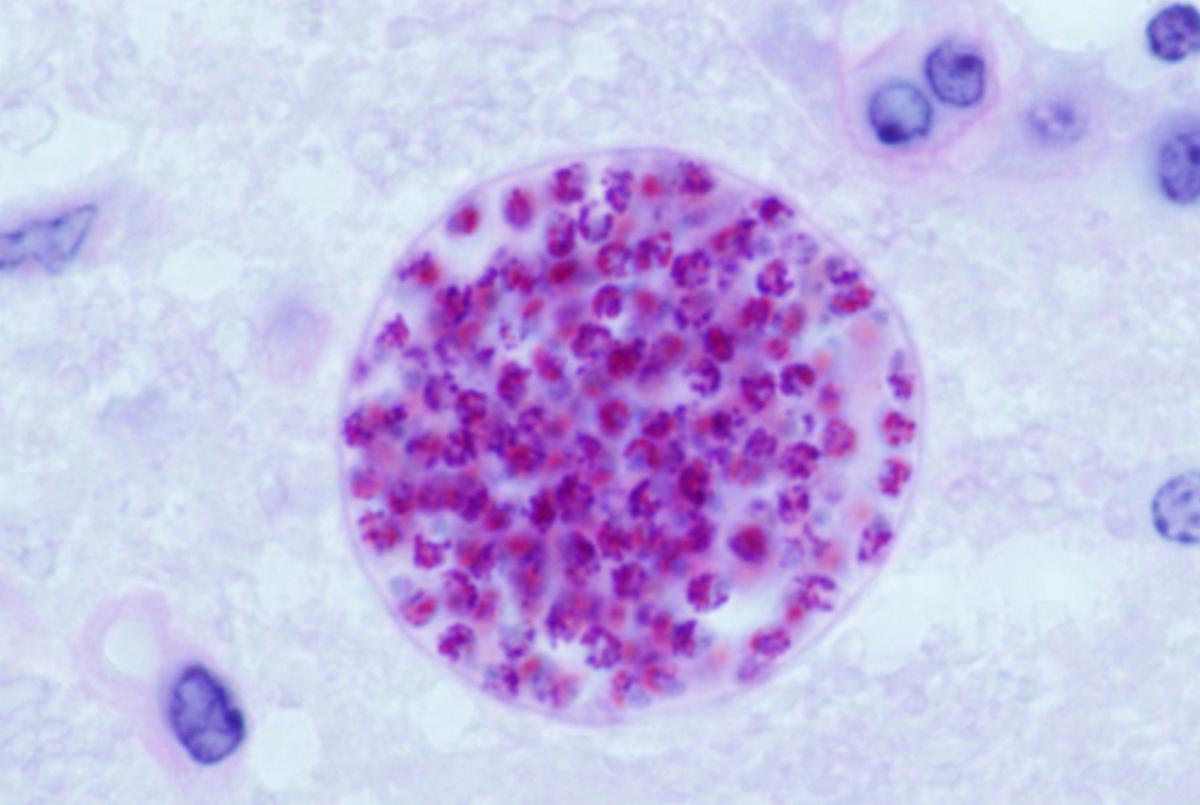 The Little-Known Parasite That Infects Millions of Americans Every Year thumbnail